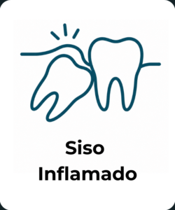 siso